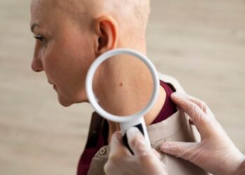 Spotting Signs Early The Importance of a Skin Cancer Check in Wollongong