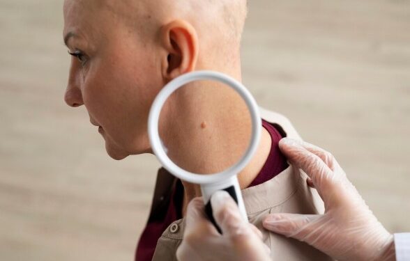 Spotting Signs Early The Importance of a Skin Cancer Check in Wollongong